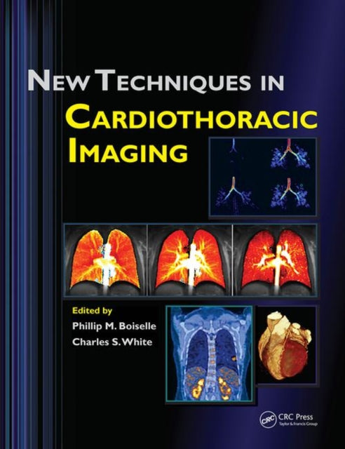 Book cover of: New Techniques in Cardiothoracic Imaging