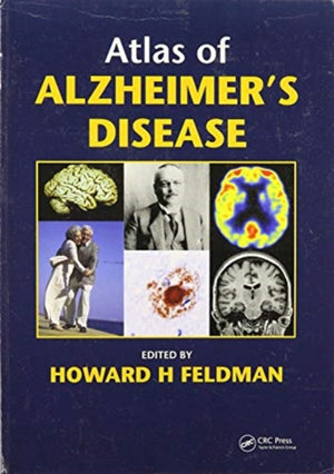 Atlas of Alzheimer's Disease