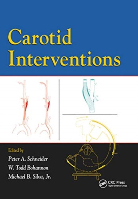 Book cover of: Carotid Interventions. By: Peter A. Schneider