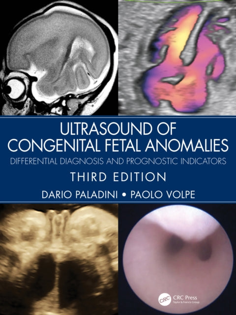Book cover of: Ultrasound of Congenital Fetal Anomalies. By: Dario Paladini
