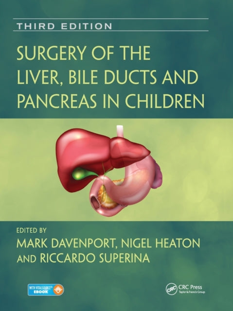 Book cover of: Surgery of the Liver, Bile Ducts and Pancreas in Children. By: Mark Davenport