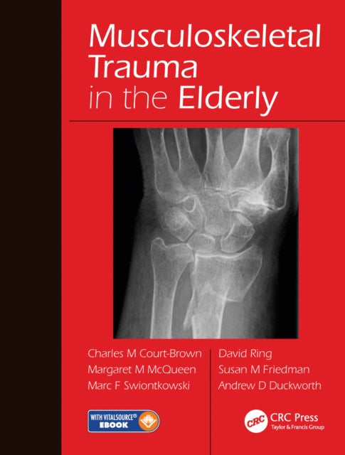Book cover of: Musculoskeletal Trauma in the Elderly. By: Charles M. Court-Brown
