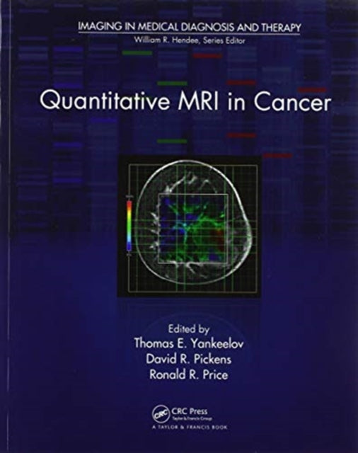 Book cover of: Quantitative MRI in Cancer. By: Thomas E. Yankeelov