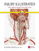 Book cover of: Injury Illustrated. By: R. Annie Gough