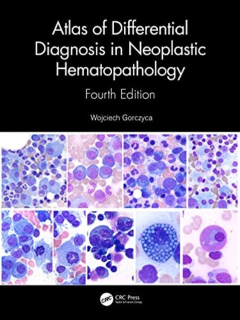 Book cover of: Atlas of Differential Diagnosis in Neoplastic Hematopathology. By: Wojciech Gorczyca