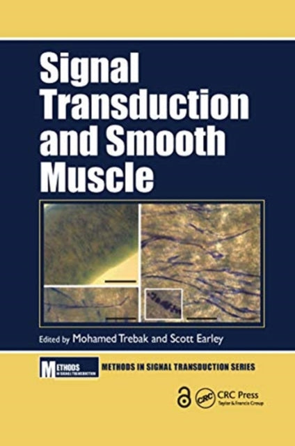 Book cover of: Signal Transduction and Smooth Muscle. By: Mohamed Trebak