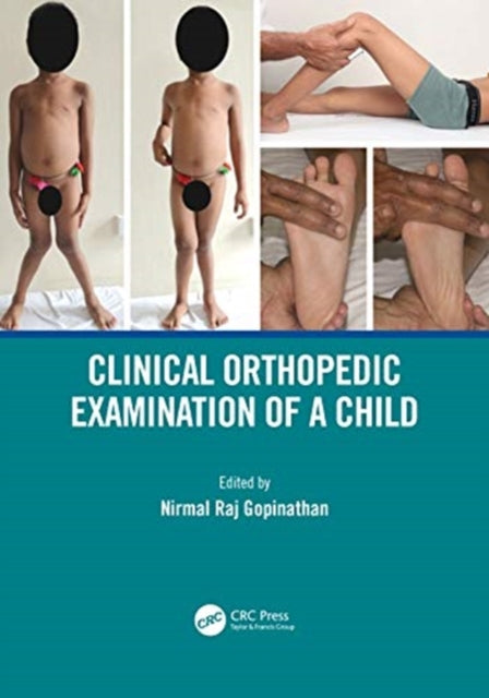Book cover of: Clinical Orthopedic Examination of a Child. By: Nirmal Raj Gopinathan