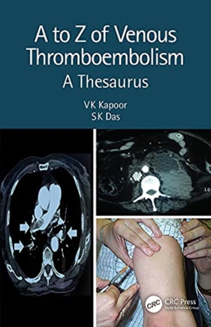 Book cover of: to Z of Venous Thromboembolism. By: V. K. Kapoor