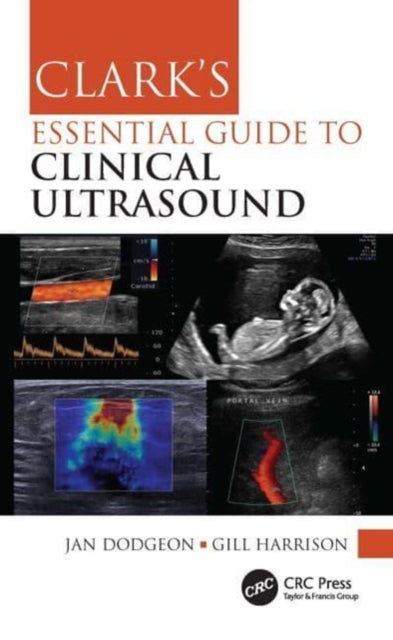Book cover of: Clark's Essential Guide to Clinical Ultrasound. By: Jan Dodgeon