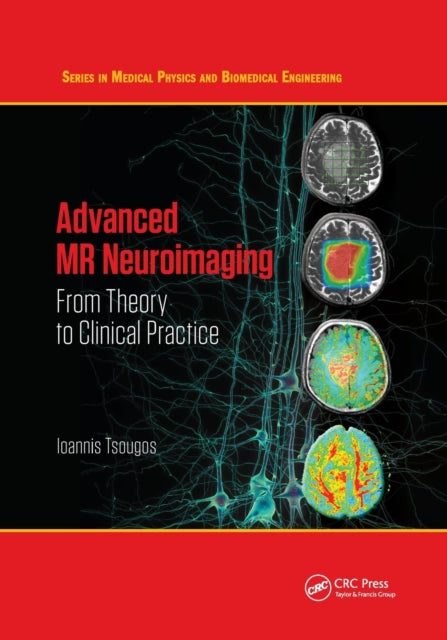 Book cover of: Advanced MR Neuroimaging. By: Ioannis Tsougos