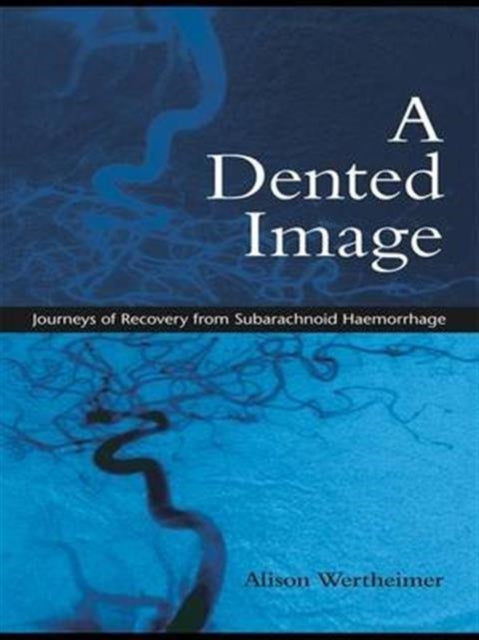 Book cover of: Dented Image. By: Alison Wertheimer