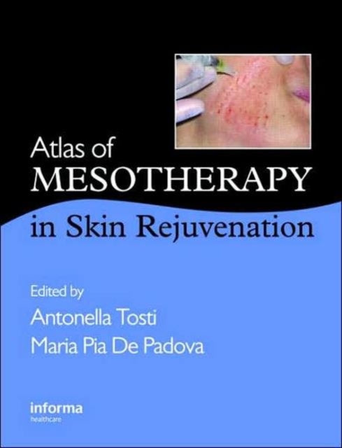Book cover of: Atlas of Mesotherapy in Skin Rejuvenation