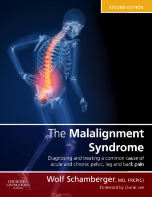 Book cover of: Malalignment Syndrome. By: Wolf Schamberger