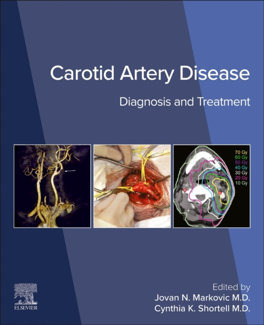 Book cover of: Carotid Artery Disease. By: Cynthia K. Shortell