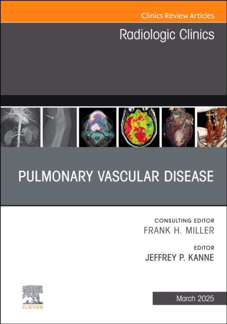 Book cover of: Pulmonary Vascular Disease, An Issue of Radiologic Clinics of North America