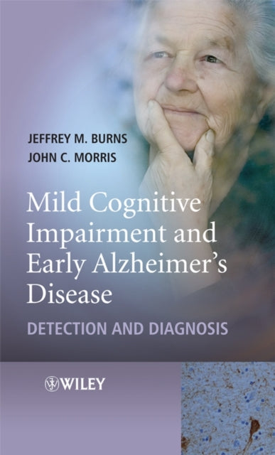 Book cover of: Mild Cognitive Impairment and Early Alzheimer's Disease. By: Jeffrey M. Burns, Jeffrey Burns