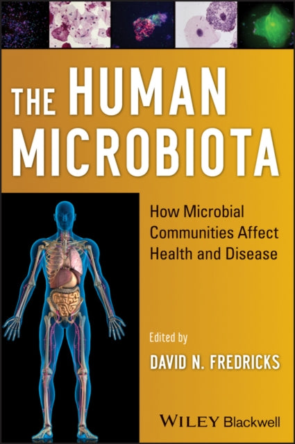 Book cover of: Human Microbiota. By: David N. Fredricks