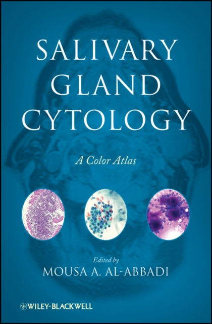 Book cover of: Salivary Gland Cytology. By: Mousa A. Al-Abbadi