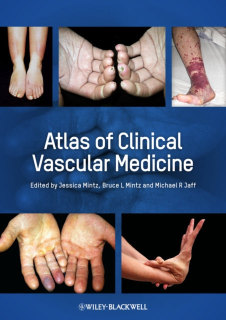 Book cover of: Atlas of Clinical Vascular Medicine