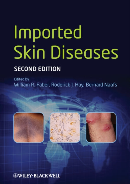 Book cover of: Imported Skin Diseases. By: William Richard Faber