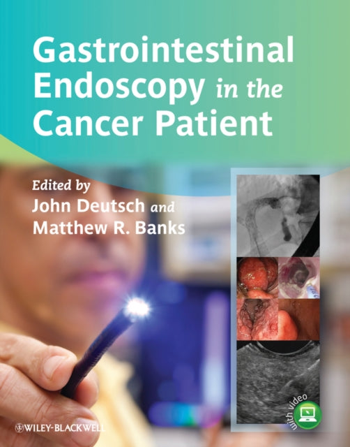 Book cover of: Gastrointestinal Endoscopy in the Cancer Patient. By: John C. Deutsch