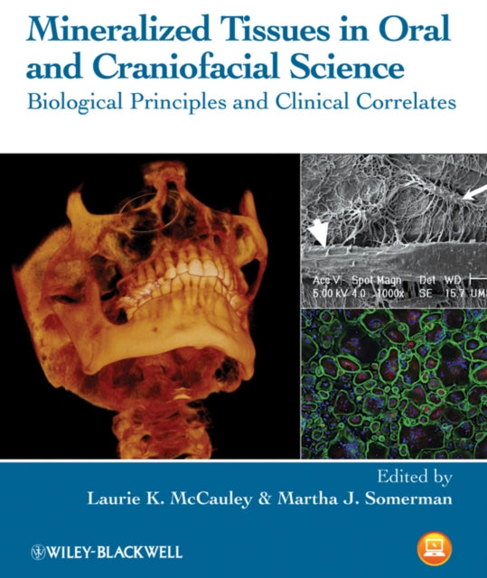 Book cover of: Mineralized Tissues in Oral and Craniofacial Science. By: Laurie K. McCauley