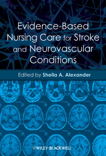 Book cover of: Evidence-Based Nursing Care for Stroke and Neurovascular Conditions. By: Sheila A. Alexander