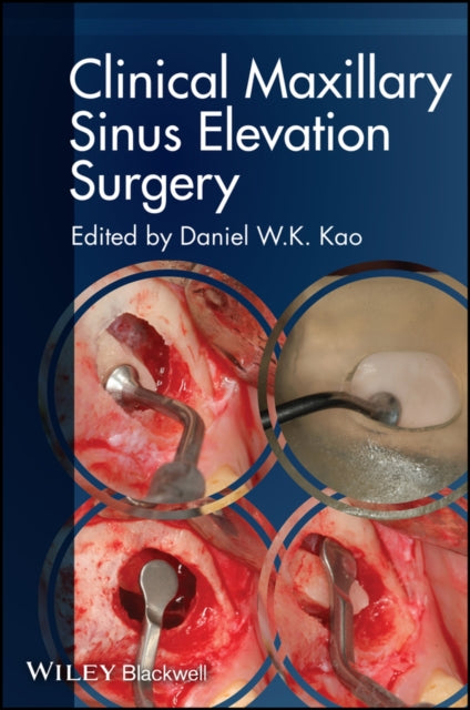 Book cover of: Clinical Maxillary Sinus Elevation Surgery