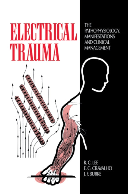 Book cover of: Electrical Trauma. By: R. C. Lee