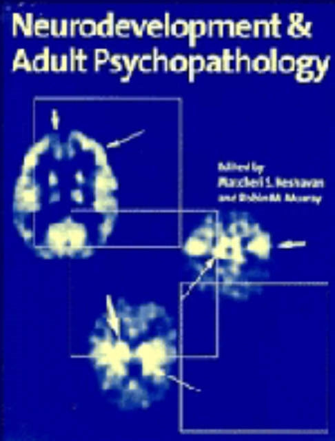Book cover of: Neurodevelopment and Adult Psychopathology