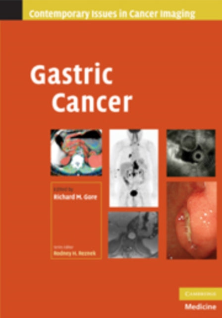 Book cover of: Gastric Cancer. By: Richard M. Gore