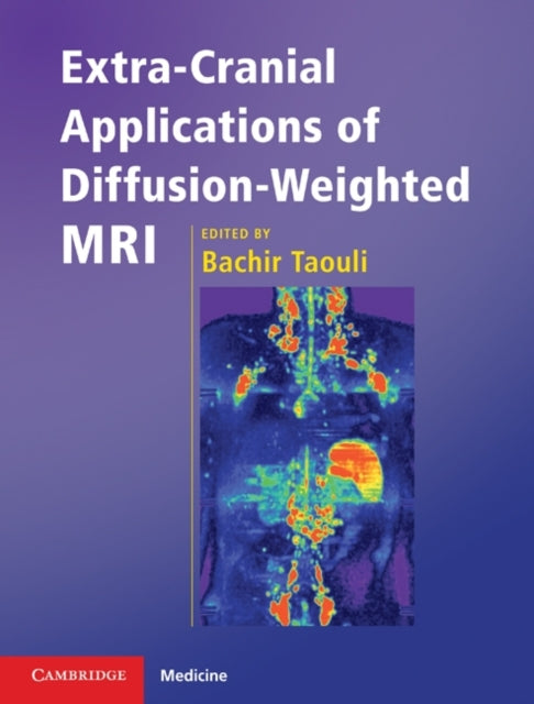 Book cover of: Extra-Cranial Applications of Diffusion-Weighted MRI