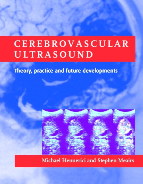 Book cover of: Cerebrovascular Ultrasound