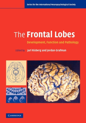Frontal Lobes