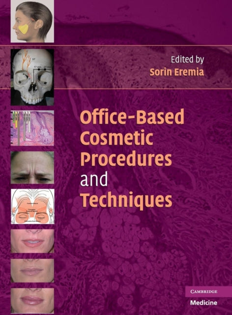 Book cover of: Office-Based Cosmetic Procedures and Techniques