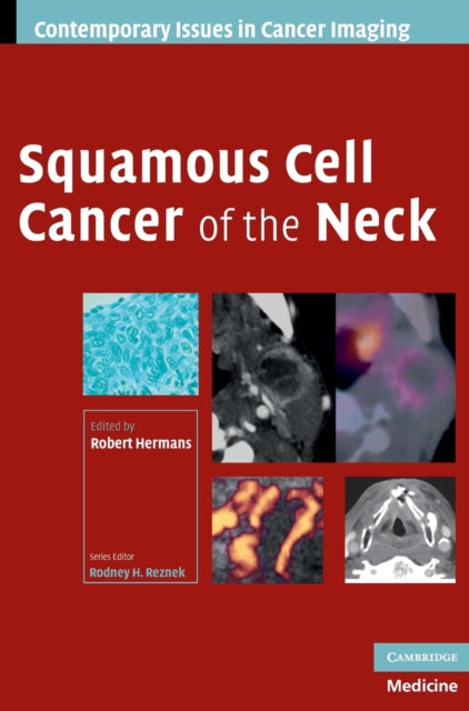 Book cover of: Squamous Cell Cancer of the Neck