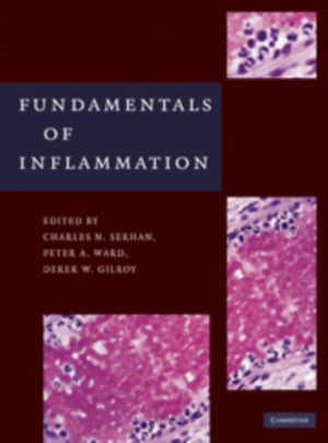 Fundamentals of Inflammation