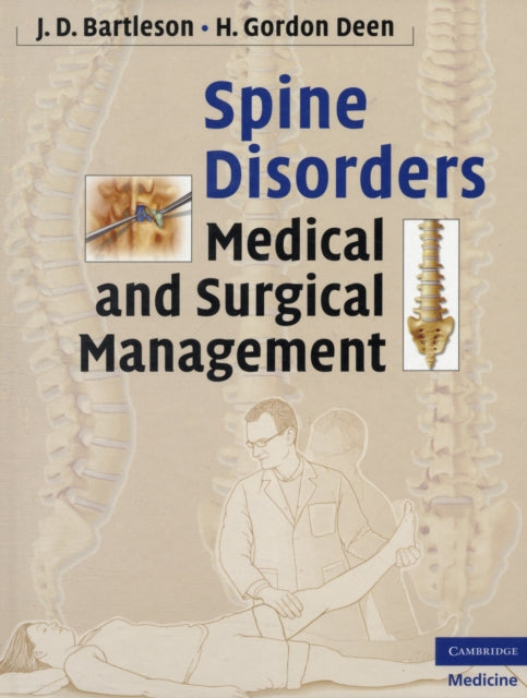 Book cover of: Spine Disorders