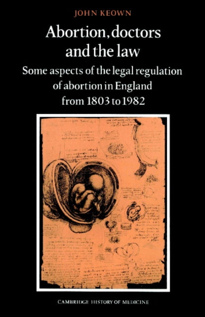 Book cover of: Abortion, Doctors and the Law. By: John Keown