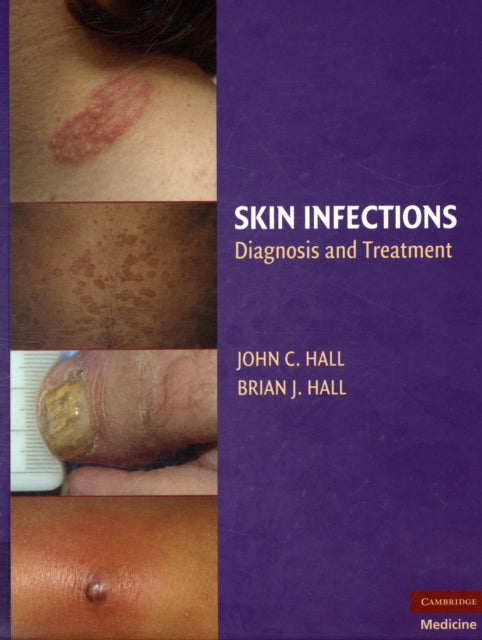 Book cover of: Skin Infections