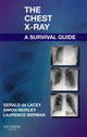 Book cover of: Chest X-Ray: A Survival Guide. By: Gerald de Lacey