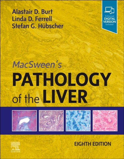 Book cover of: MacSween's Pathology of the Liver. By: Alastair D. Burt