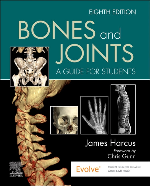 Book cover of: Bones and Joints. By: James Harcus
