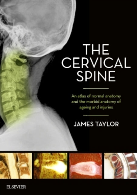Book cover of: Cervical Spine. By: James Taylor