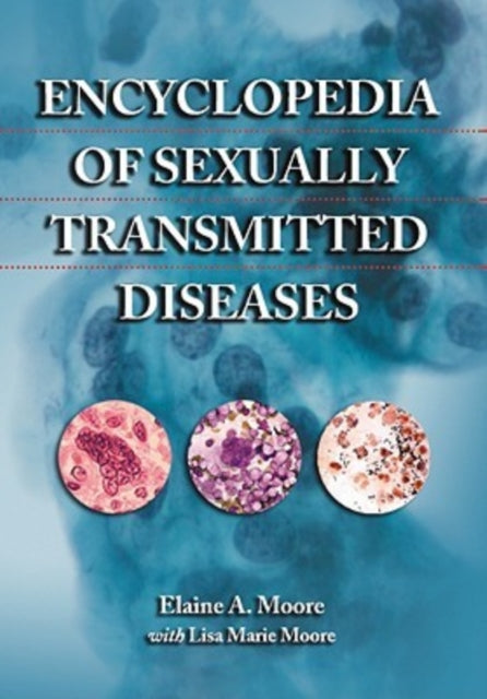 Book cover of: Encyclopedia of Sexually Transmitted Diseases. By: Elaine A. Moore