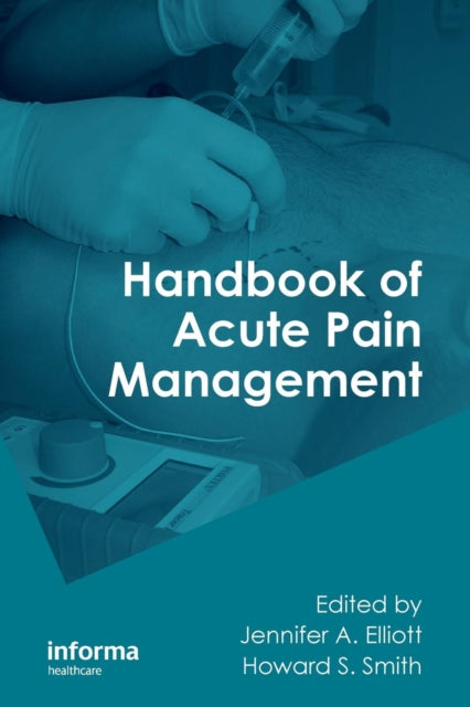 Book cover of: Handbook of Acute Pain Management