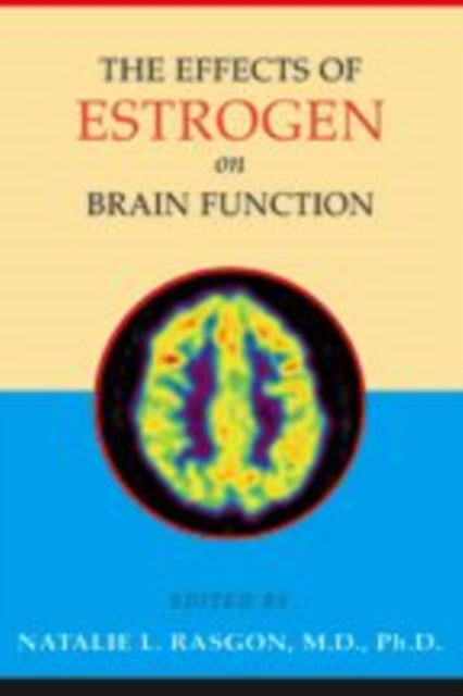 Book cover of: Effects of Estrogen on Brain Function