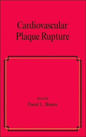Cardiovascular Plaque Rupture