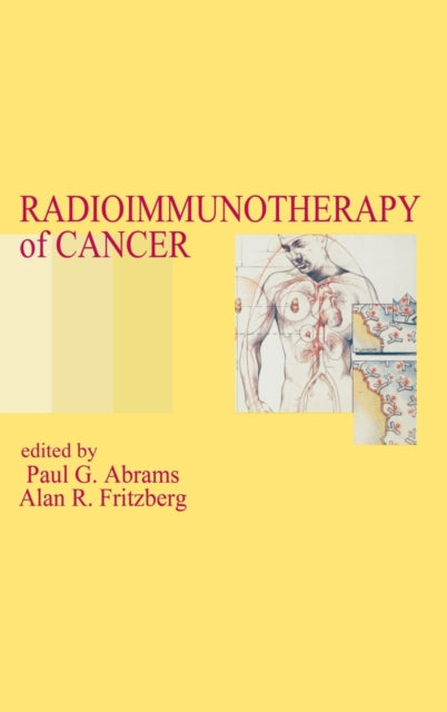 Book cover of: Radioimmunotherapy of Cancer. By: Abrams/Fritzber