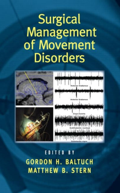 Book cover of: Surgical Management of Movement Disorders